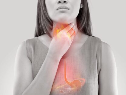 pálenie záhy Praktici alternatívnej medicíny dlho propagovali mastichovú gumu ako prírodný liek na poruchy trávenia, reflux kyseliny, peptické vredy, zápalové ochorenie čriev (IBD), problémy s dýchaním, ochorenia ďasien a rôzne bakteriálne alebo plesňové infekcie.Pálenie záhy je bežným príznakom refluxu, stavu, keď časť obsahu žalúdka putuje späť do pažeráka alebo tráviacej trubice. Vytvára pálivú bolesť v dolnej časti hrudníka