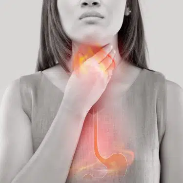 pálenie záhy Praktici alternatívnej medicíny dlho propagovali mastichovú gumu ako prírodný liek na poruchy trávenia, reflux kyseliny, peptické vredy, zápalové ochorenie čriev (IBD), problémy s dýchaním, ochorenia ďasien a rôzne bakteriálne alebo plesňové infekcie.Pálenie záhy je bežným príznakom refluxu, stavu, keď časť obsahu žalúdka putuje späť do pažeráka alebo tráviacej trubice. Vytvára pálivú bolesť v dolnej časti hrudníka