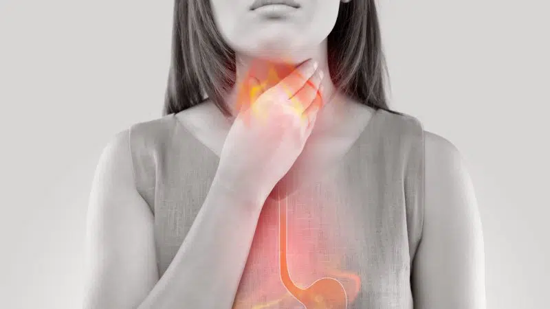 pálenie záhy Praktici alternatívnej medicíny dlho propagovali mastichovú gumu ako prírodný liek na poruchy trávenia, reflux kyseliny, peptické vredy, zápalové ochorenie čriev (IBD), problémy s dýchaním, ochorenia ďasien a rôzne bakteriálne alebo plesňové infekcie.Pálenie záhy je bežným príznakom refluxu, stavu, keď časť obsahu žalúdka putuje späť do pažeráka alebo tráviacej trubice. Vytvára pálivú bolesť v dolnej časti hrudníka
