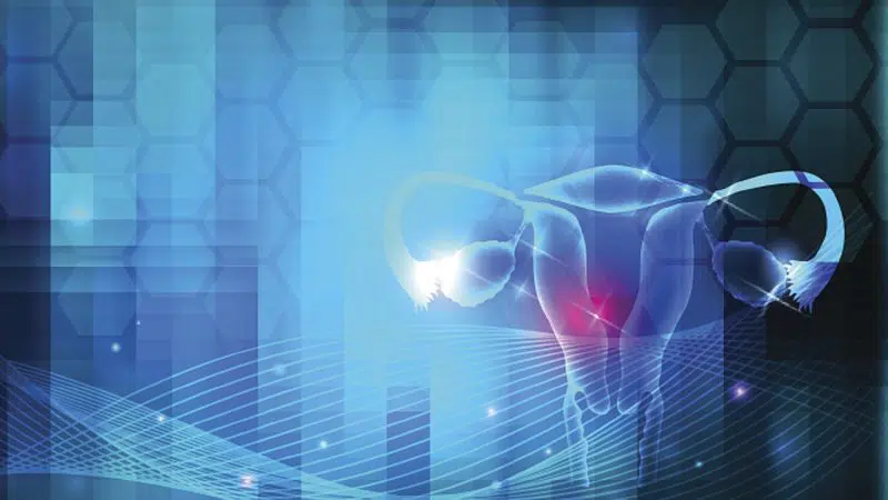 Ženy s PCOS produkujú vyššie než normálne množstvá mužských hormónov. Táto hormonálna nerovnováha spôsobuje, že ich telo vynecháva menštruačné obdobia a sťažuje im otehotnenie. Syndróm polycystických vaječníkov tiež spôsobuje rast vlasov na tvári a tele a plešatosť. A môže prispieť k dlhodobým zdravotným problémom, ako je cukrovka a srdcové choroby.